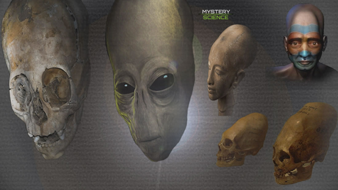 El enigma de los cráneos alargados de diferentes culturas