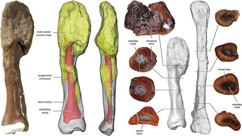 Descubren cáncer en el fósil de un dinosaurio