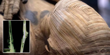 Momia de hace 2.600 años hallada con evidencias de un procedimiento quirúrgico avanzado