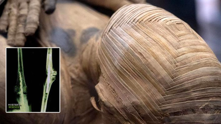 Momia de hace 2.600 años hallada con evidencias de un procedimiento quirúrgico avanzado