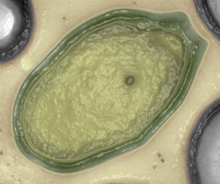 Pandoravirus visto bajo el microscopio