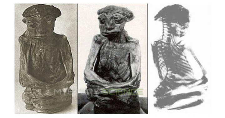 Fotos y radiografía de la Momia de San Pedro